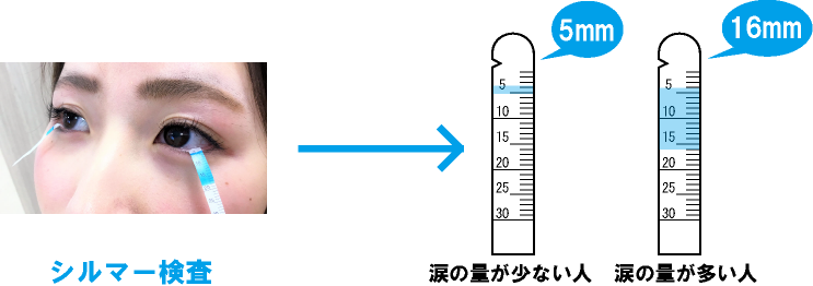 シルマー試験